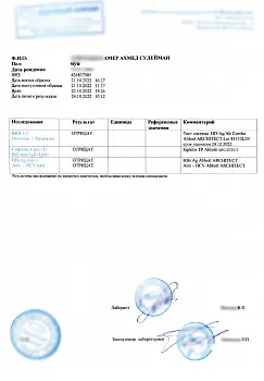 Купить анализ на ВИЧ, RW (сифилис) и гепатиты. Доступно в Москве. Купить анализ на ВИЧ, RW (сифилис) и гепатиты. Доступно в Москве.