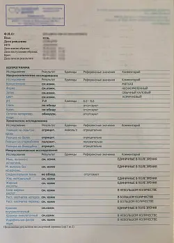 Купить общий анализ кала за 219 у.е. в Москве. Купить общий анализ кала за 219 у.е. в Москве.